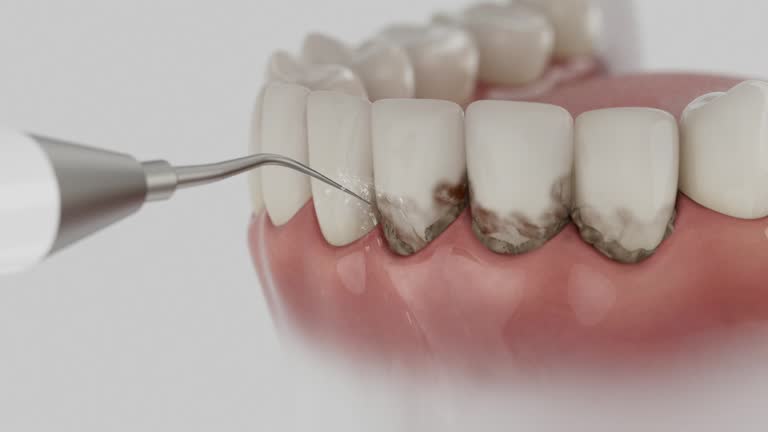 Reliable Dental contractor in Olivette, MO by Dentist Open Now